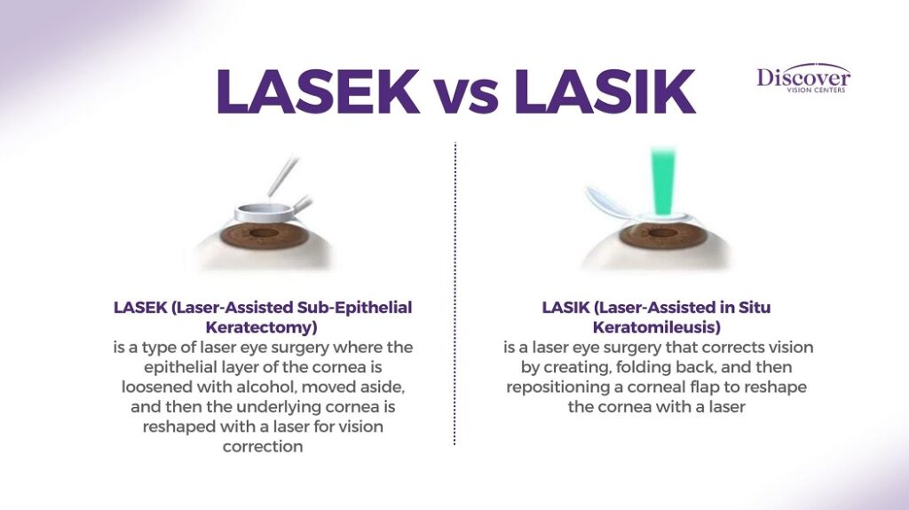 LASEK vs. LASIK Pros and Cons