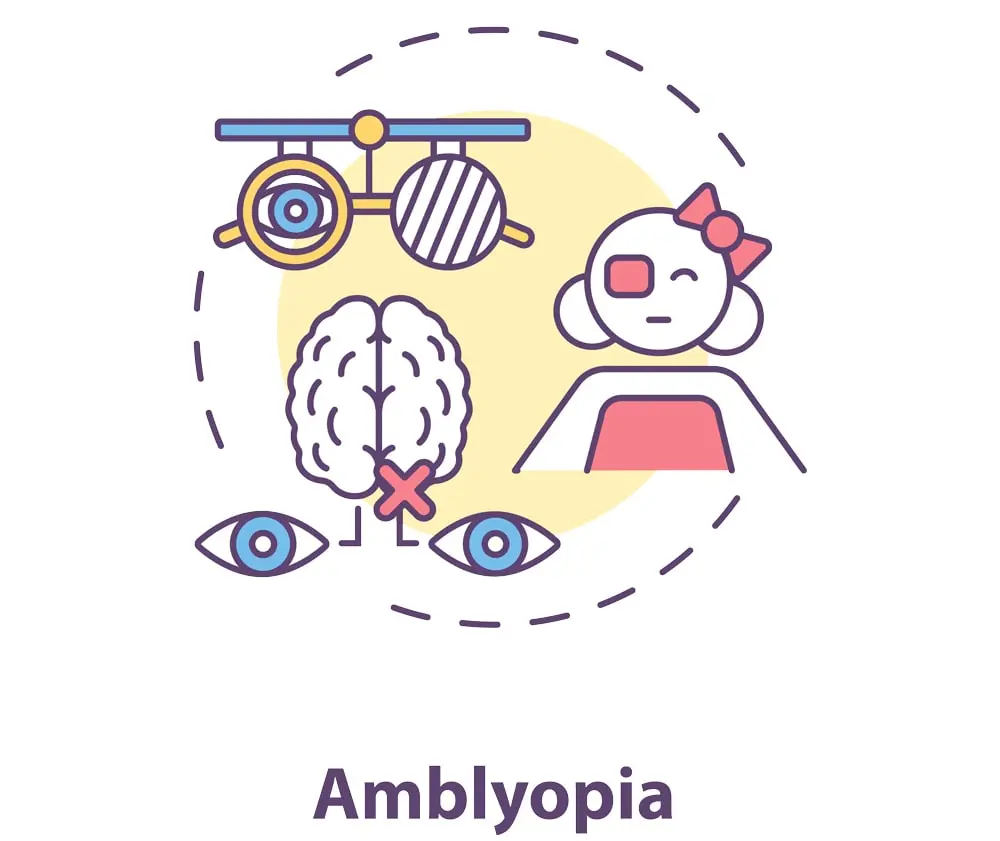 Types of Amblyopia