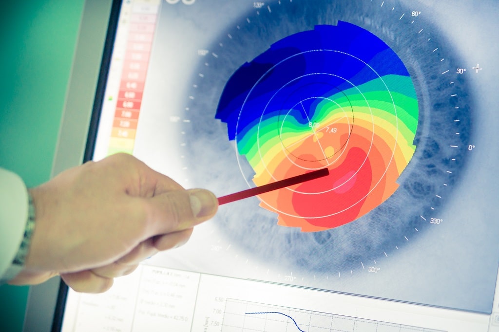 can keratoconus cause blindness