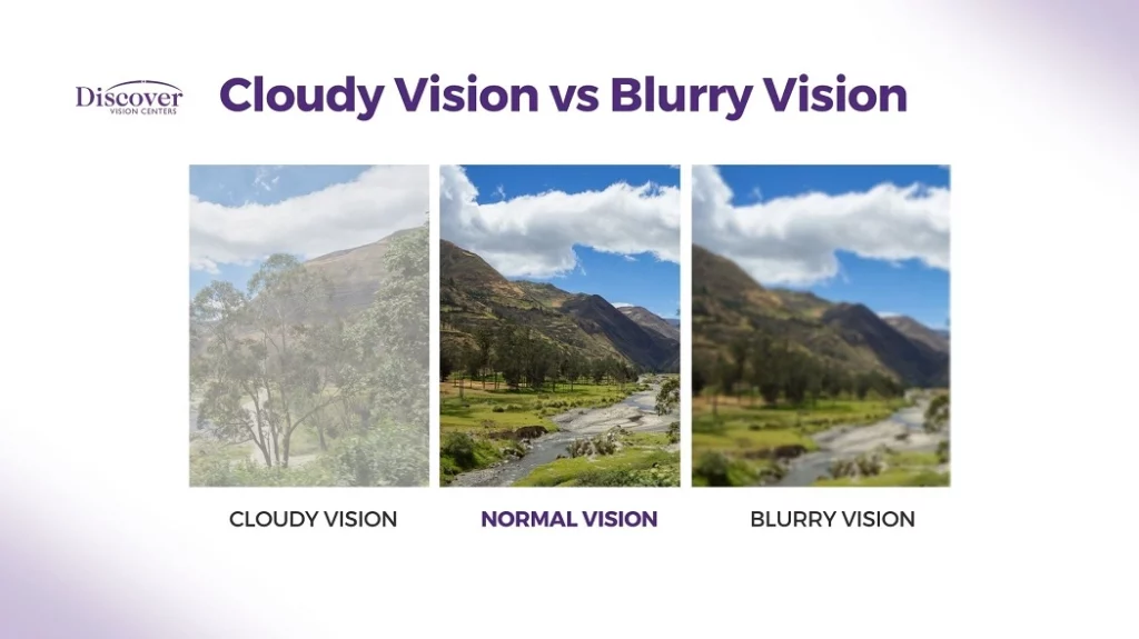 Cloudy Vision vs Blurry Vision: What’s the Difference? 