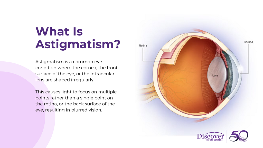 What Is Astigmatism