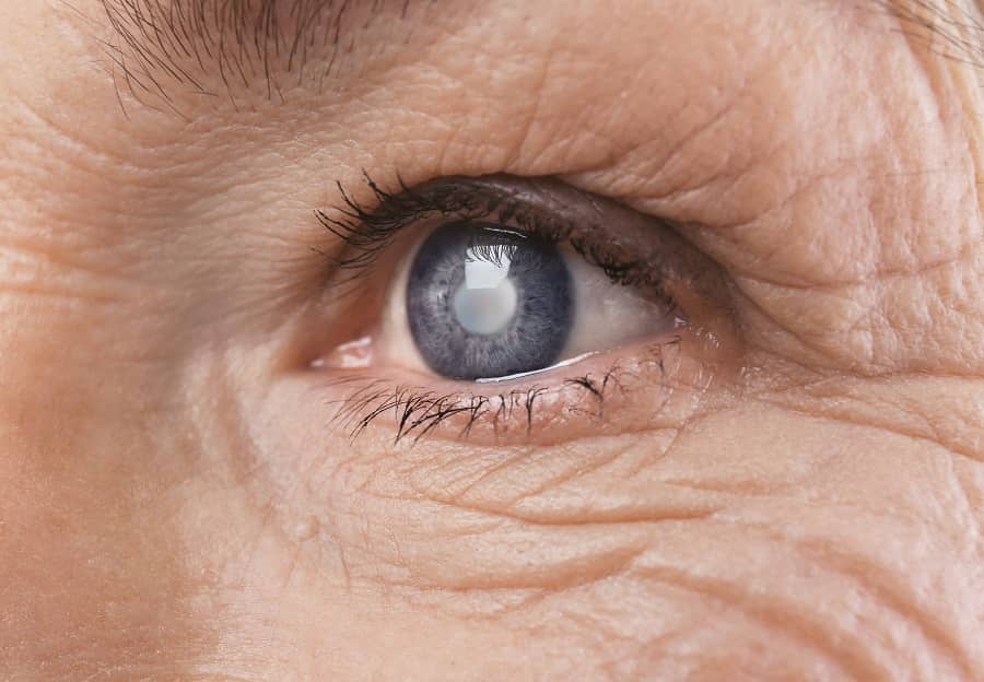 is cataract surgery painful