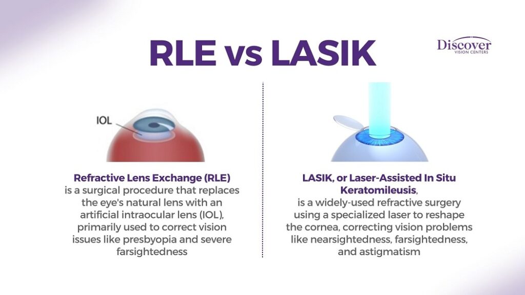 LASIK vs RLE: Key Differences