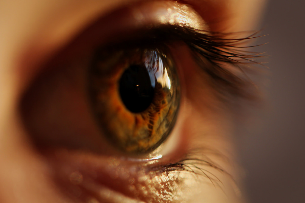 myopia of eyes