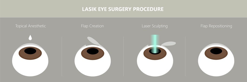 procedure steps