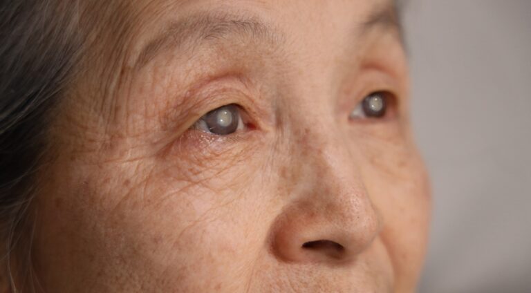 5 Warning Signs of Cataracts You Shouldn’t Ignore