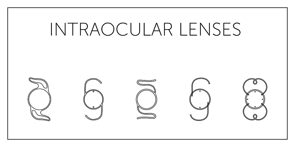 intraocular lens implant procedure