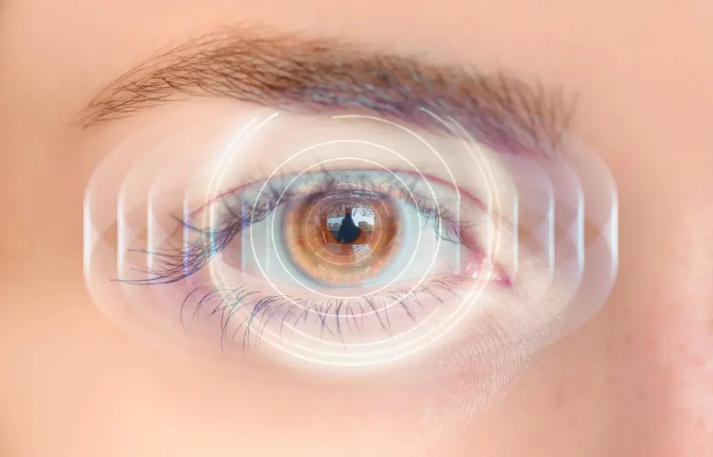 Understanding ICL and SMILE: An Overview of Procedures