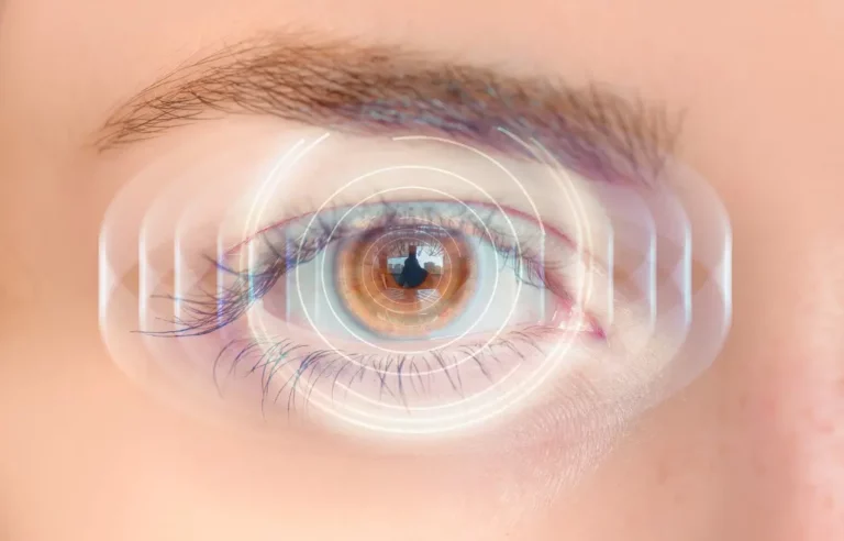 SMILE vs ICL: A Comprehensive Comparison of Advanced Vision Correction Procedures