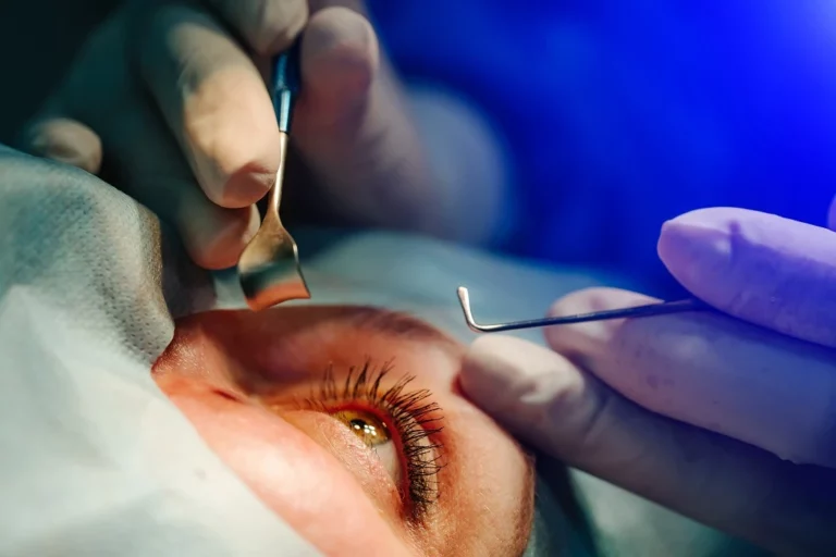 What Are the Pros and Cons of Cataract Surgery?
