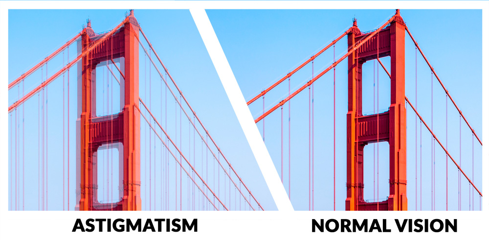 what does astigmatism look like