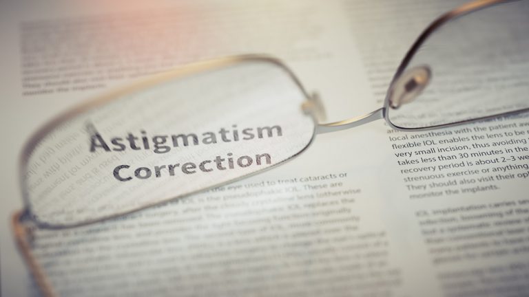 Astigmatism: Causes, Symptoms & Treatment