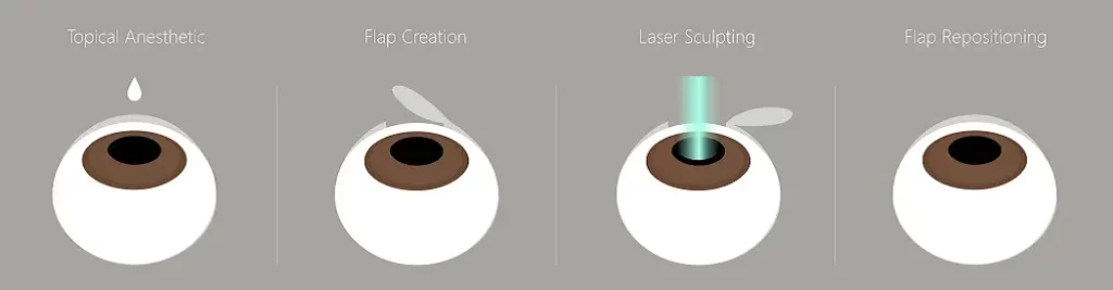 What to Expect During Evaluation for Farsightedness